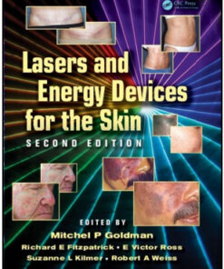 Lasers and Energy Devices for the Skin, 2ed