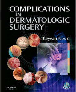 Complications in Dermatologic Surgery with