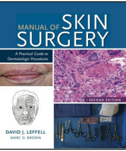 Manual of Skin Surgery: A Practical Guide to Dermatologic Procedures, 2nd Edition