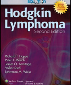 Hodgkin Lymphoma, 2nd Edition