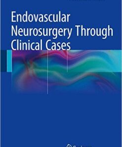 Endovascular Neurosurgery Through Clinical Cases 2015th Edition