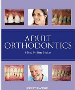Adult Orthodontics 1st Edition