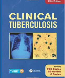 Clinical Tuberculosis, Fifth Edition 5th Edition
