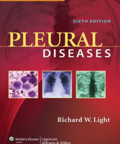 Pleural Diseases Sixth Edition