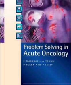 Problem Solving in Acute Oncology 1st Edition