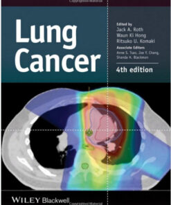 Lung Cancer 4th Edition