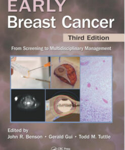 Early Breast Cancer: From Screening to Multidisciplinary Management, Third Edition 3rd Edition