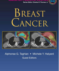 Breast Cancer (Radiation Medicine Rounds Volume 3 Issue 1) 1st Edition