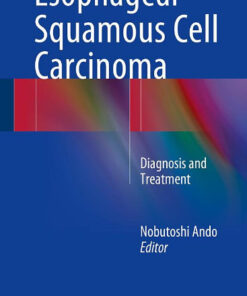 Esophageal Squamous Cell Carcinoma: Diagnosis and Treatment 2015th Edition
