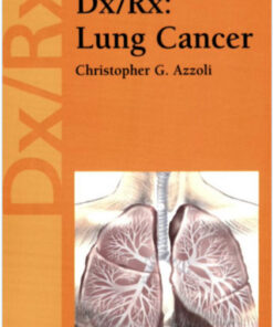 Dx/Rx: Lung Cancer (Jones and Bartlett Publishers DX/RX Oncology) 1st Edition