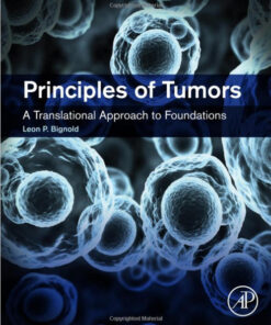 Principles of Tumors 1st Edition