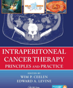 Intraperitoneal Cancer Therapy: Principles and Practice  Edition