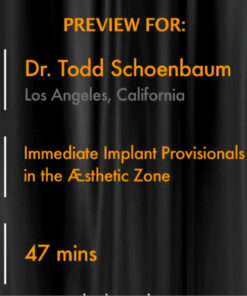 Immediate Implant Provisionals in the Aesthetic Zone
