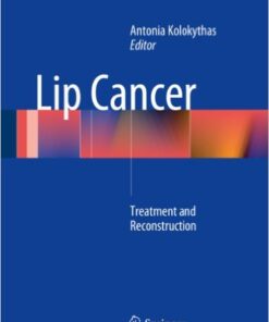 Lip Cancer: Treatment and Reconstruction 2014th Edition