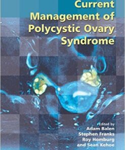 Current Management of Polycystic Ovary Syndrome  1st Edition