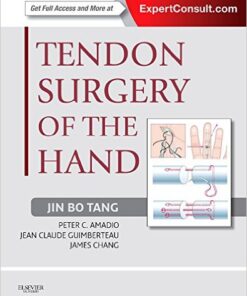 Tendon Surgery of the Hand: Expert Consult  1e