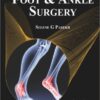 Foot and Ankle Surgery 1st Edition