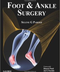 Foot and Ankle Surgery 1st Edition