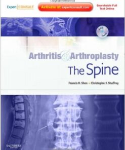 Arthritis and Arthroplasty: The Spine: Expert Consult  1e