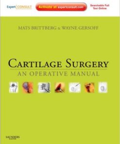Cartilage Surgery: An Operative Manual 1e