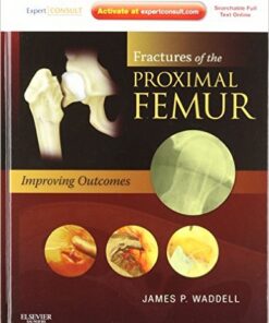 Fractures of the Proximal Femur: Improving Outcomes1e 1st Edition