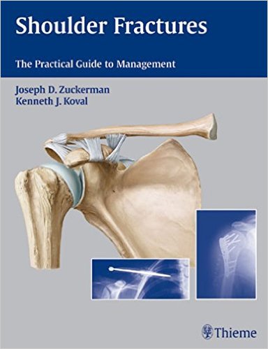 Shoulder Fractures: The Practical Guide to Management