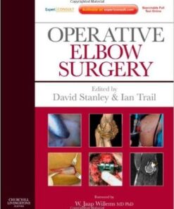 Operative Elbow Surgery: Expert Consult 1e