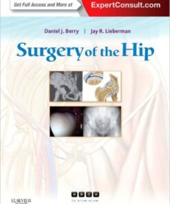 Surgery of the Hip: Expert Consult - 1e Har/Psc Edition