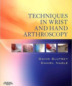 Techniques in Wrist and Hand Arthroscopy Kindle Edition