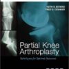 Partial Knee Arthroplasty: Techniques for Optimal Outcomes 1e