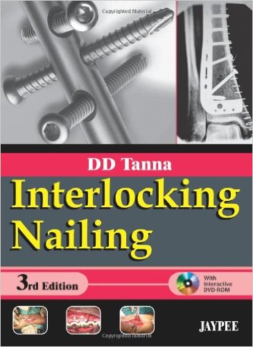 Interlocking Nailing 3 Har/Dvdr Edition