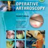 Operative Arthroscopy Fourth Edition