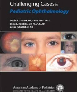 Challenging Cases in Pediatric Ophthalmology 1st Edition