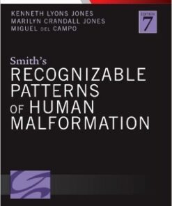 Smith's Recognizable Patterns of Human Malformation 7e