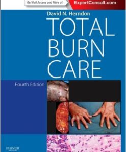 Total Burn Care 4th Edition