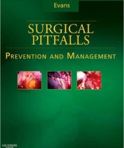 Surgical Pitfalls: Prevention and Management Kindle Edition