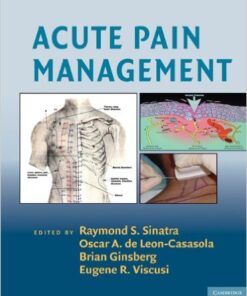 Acute Pain Management (Cambridge Medicine) 1st Edition