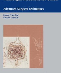 Multiorgan Resections for Cancer: Advanced Surgical Techniques Kindle Edition