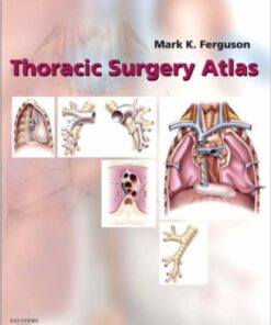 Thoracic Surgery Atlas, 1e 1st Edition