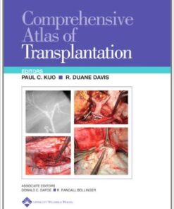 Comprehensive Atlas of Transplantation Hardcover – September 8, 2004