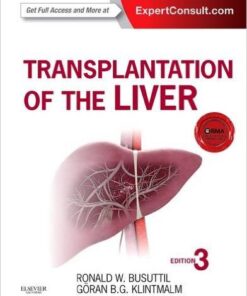 Transplantation of the Liver, 3e 3rd Edition