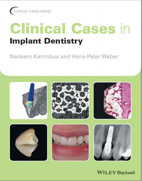 Clinical Cases in Implant Dentistry (Clinical Cases (Dentistry))-Original PDF