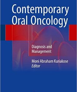 Contemporary Oral Oncology: Diagnosis and Management 1st ed. 2017 Edition