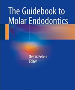 The Guidebook to Molar Endodontics 1st ed. 2017 Edition