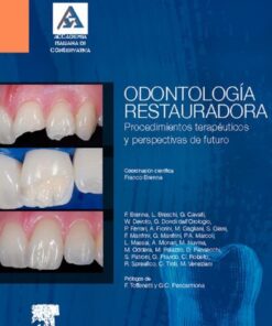 Odontología restauradora: Procedimientos terapéuticos y perspectivas de futuro (Spanish Edition)