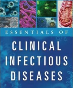 Essentials of Clinical Infectious Diseases 1st Edition
