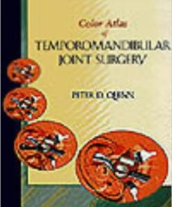 Color Atlas Of Temporomandibular Joint Surgery, 1e