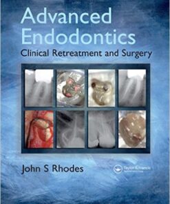 Advanced Endodontics 1st Edition