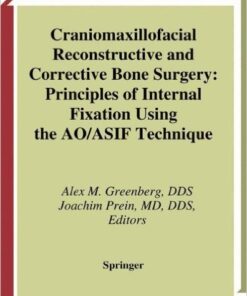 Craniomaxillofacial Reconstructive and Corrective Bone Surgery: Principles of Internal Fixation Using AO/ASIF Technique 2002nd Edition