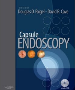 Capsule Endoscopy: Text with DVD, 1e 1Edition